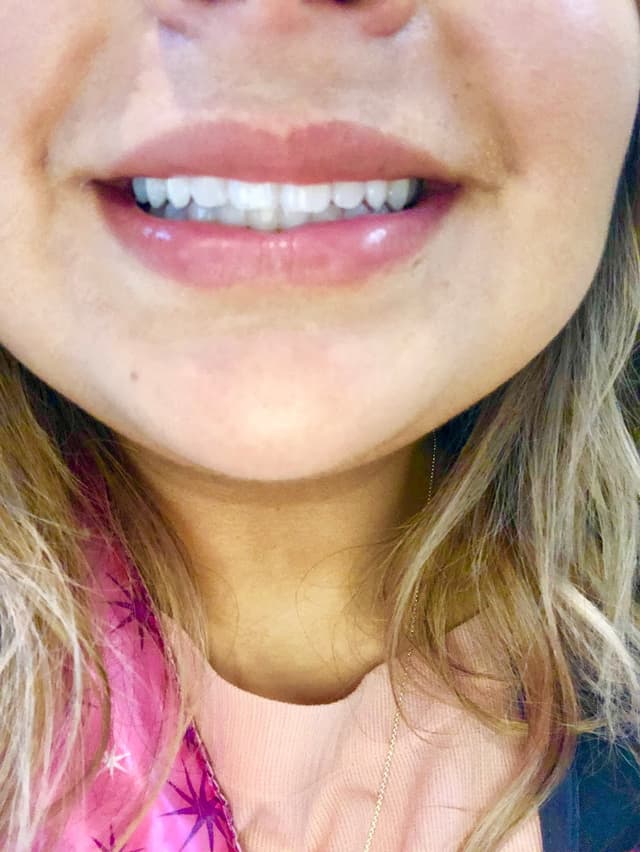 Cosmetic Smiles photo