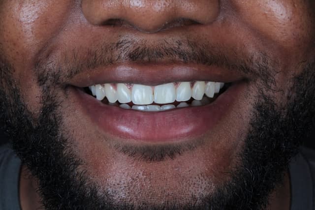 Smiles of Riverstone photo