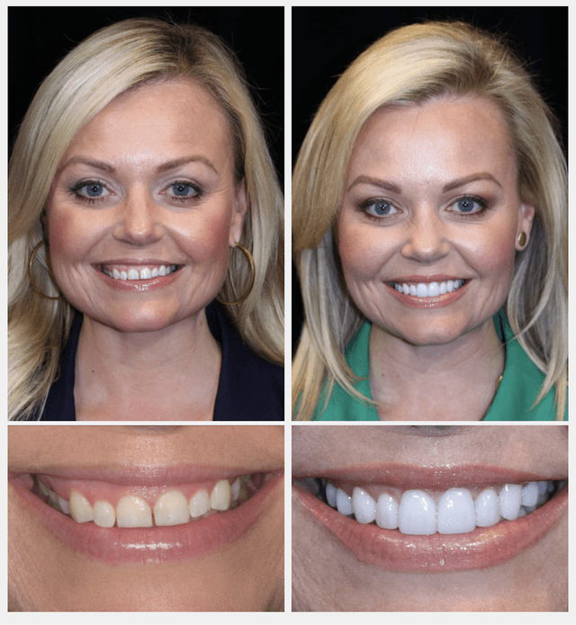 Smile Texas photo