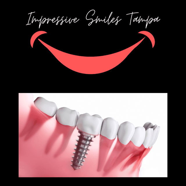 Impressive Smiles Tampa - Carrollwood photo