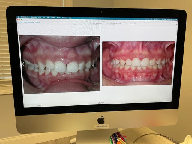 Torres Orthodontics photo