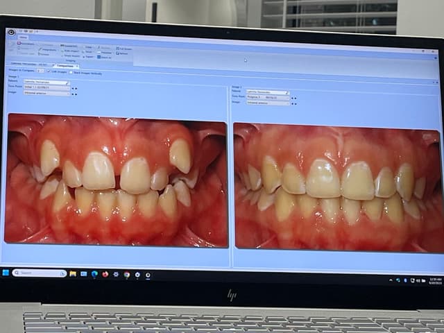 GO Orthodontics Tampa photo
