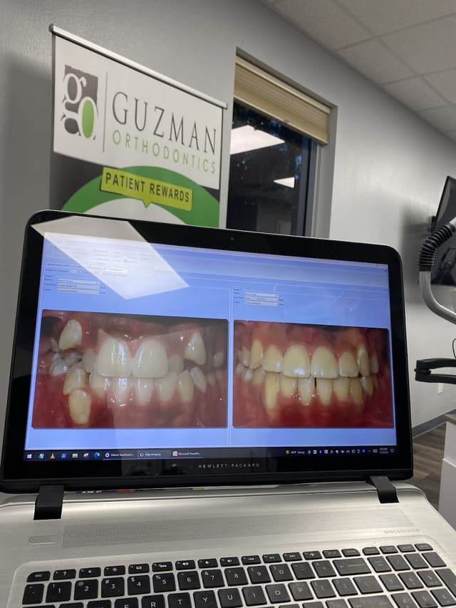 GO Orthodontics Tampa photo