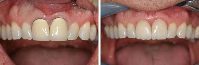 South Tampa Smiles photo