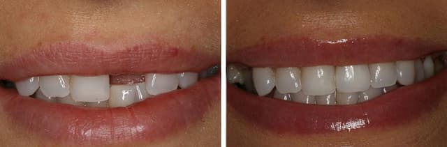 South Tampa Smiles photo