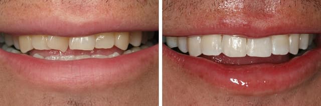 South Tampa Smiles photo