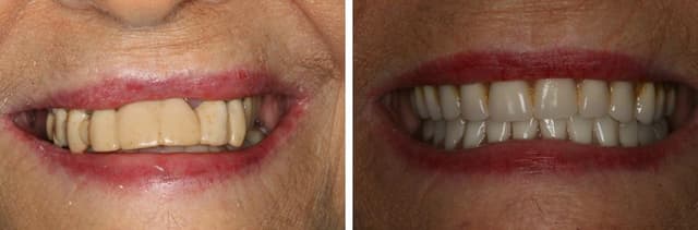 South Tampa Smiles photo