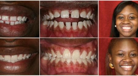 South Tampa Smiles photo