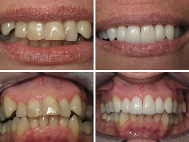 South Tampa Smiles photo