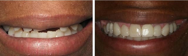 South Tampa Smiles photo