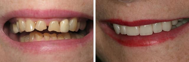 South Tampa Smiles photo