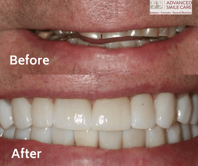 Advanced Smile Care photo