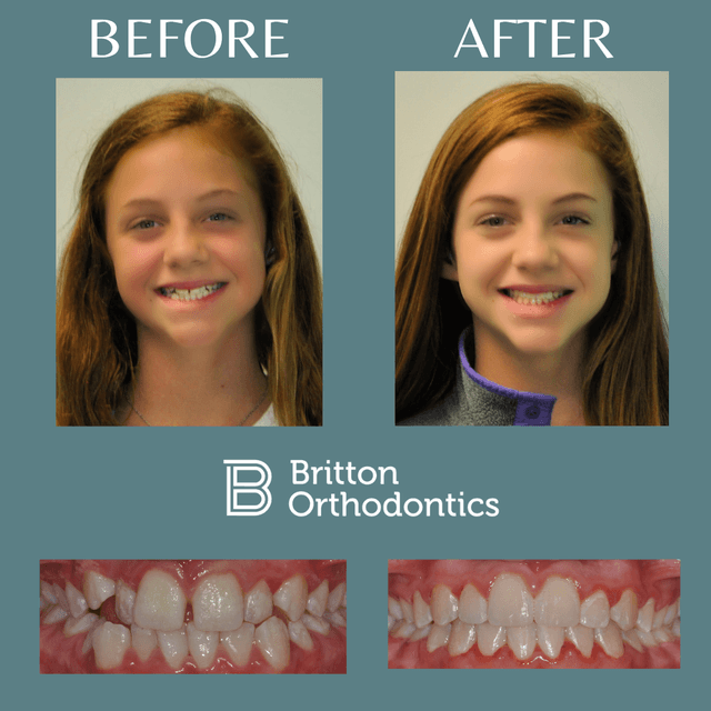 Britton Orthodontics photo