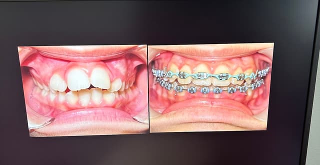Beitchman Orthodontics photo