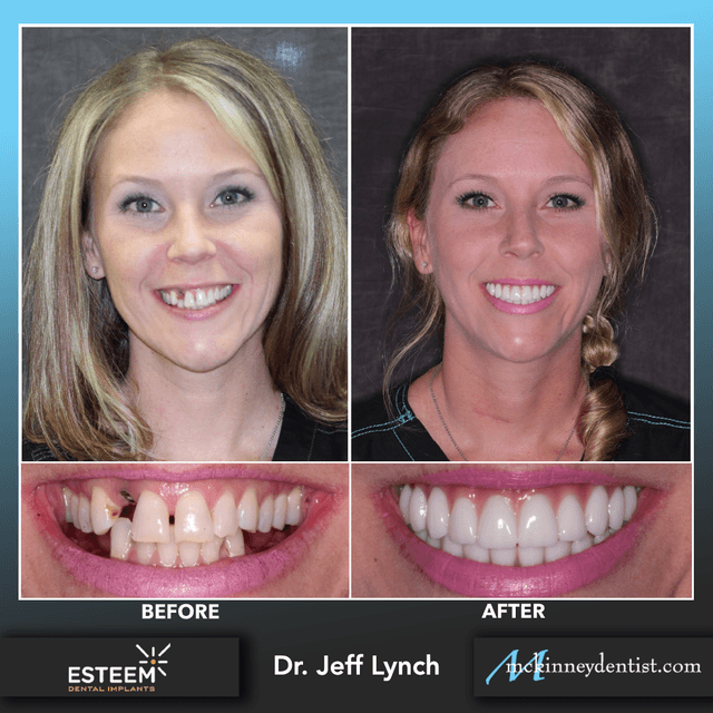McKinneydentist.com photo