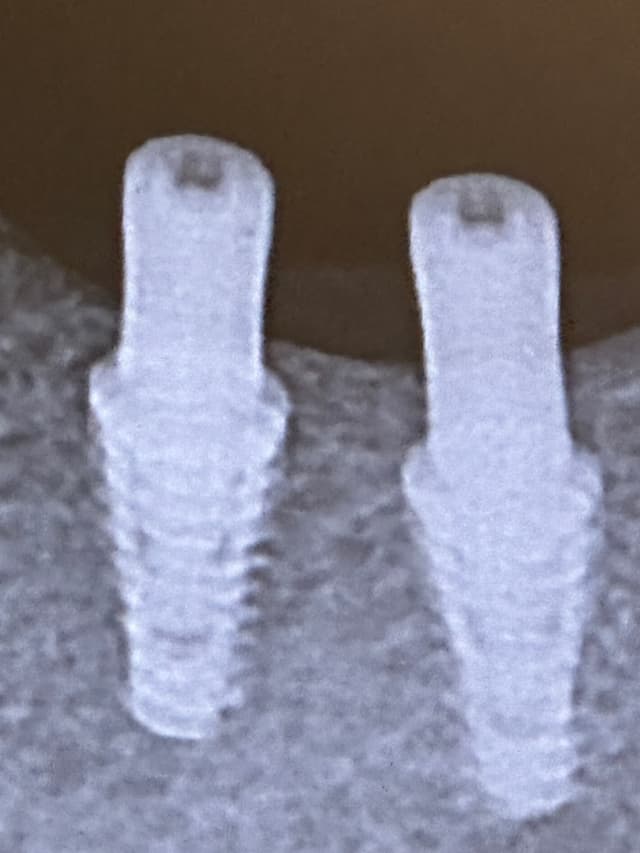 Periodontics & Implant Center of Hoboken photo