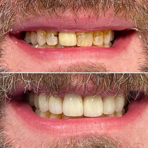 Picture Perfect Smile photo
