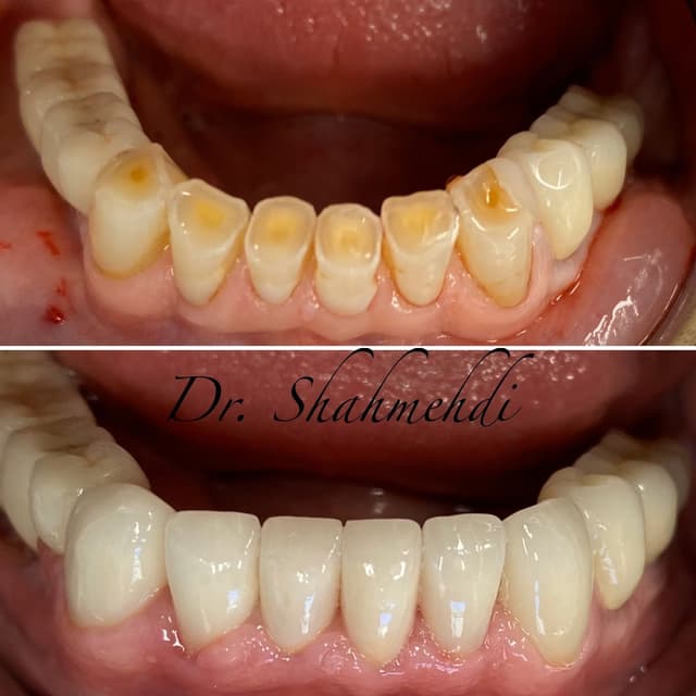 Picture Perfect Smile photo