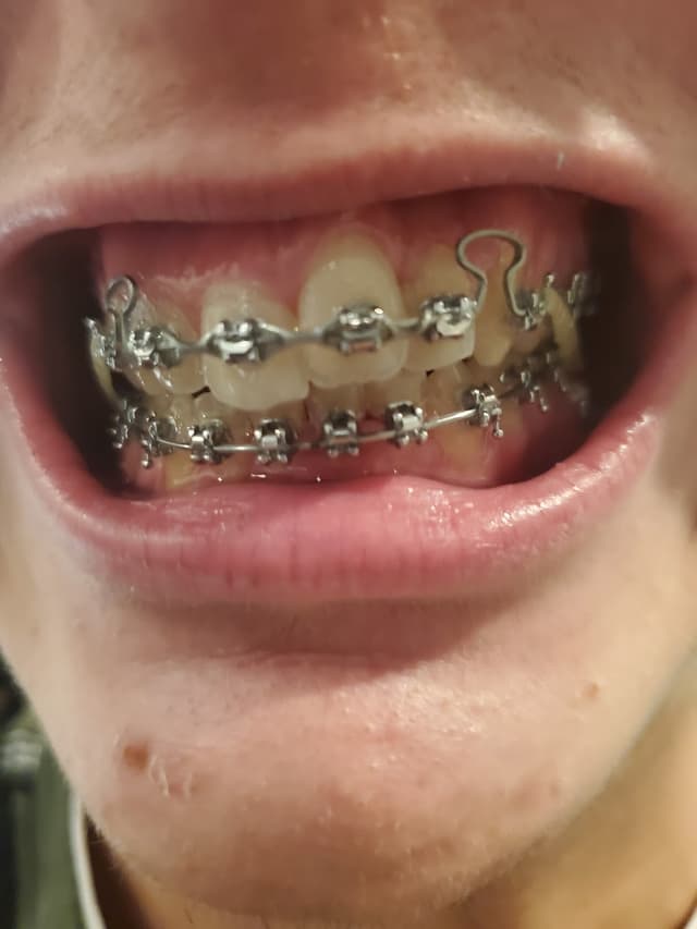 Picture Perfect Smile photo