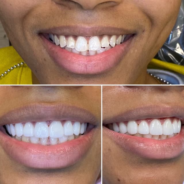 Picture Perfect Smile photo