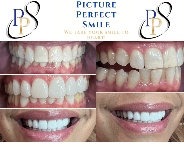 Picture Perfect Smile photo