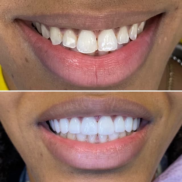 Picture Perfect Smile photo