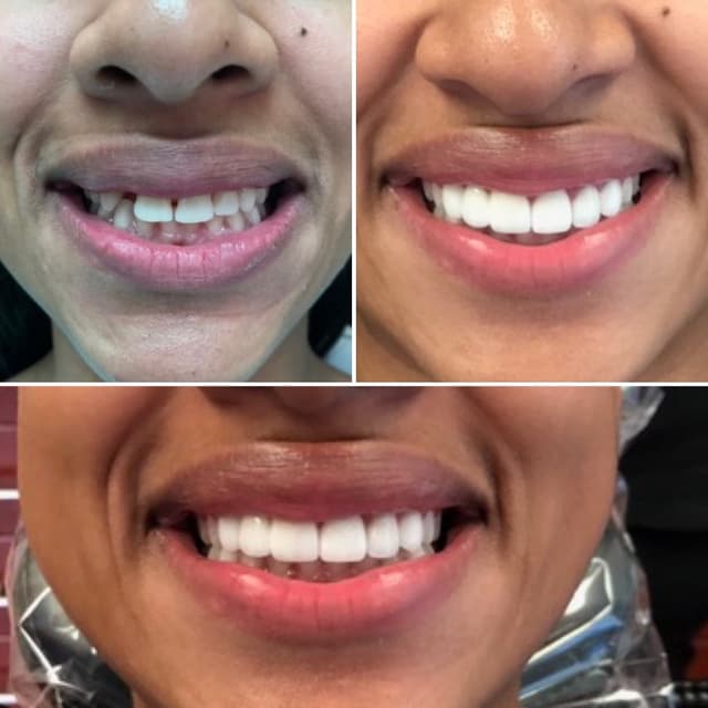 Picture Perfect Smile photo