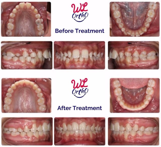 West Loop Orthodontics photo