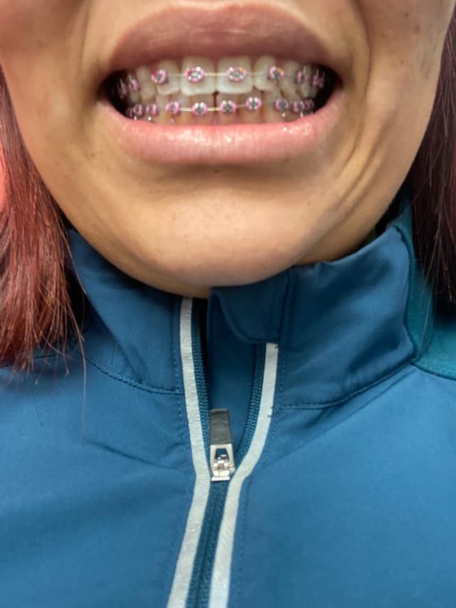 North Ave Braces photo