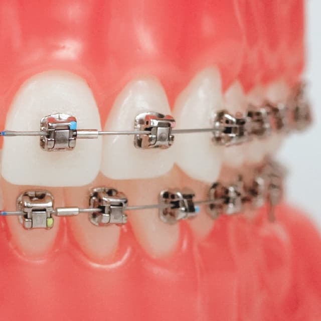 Associated Orthodontists - Joliet photo