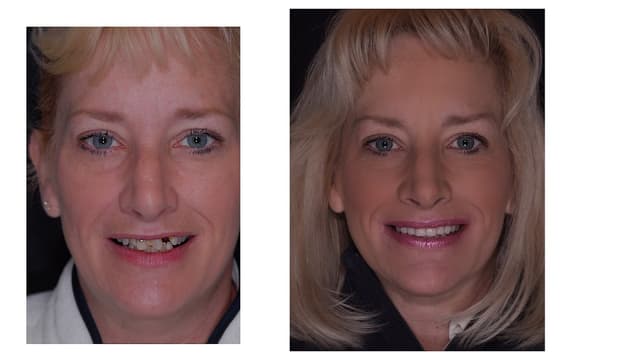 Port Jefferson Smiles photo