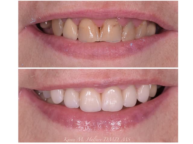 Port Jefferson Smiles photo
