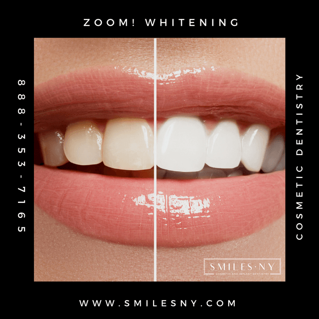 SmilesNY photo