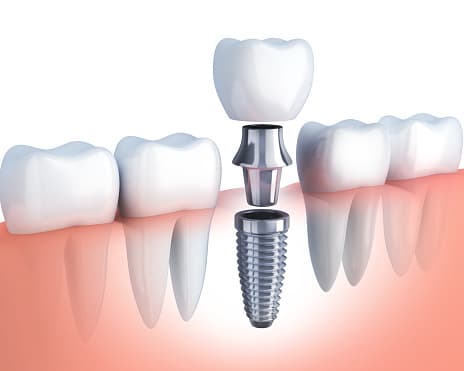 Jutkowitz Periodontics & Implantology photo