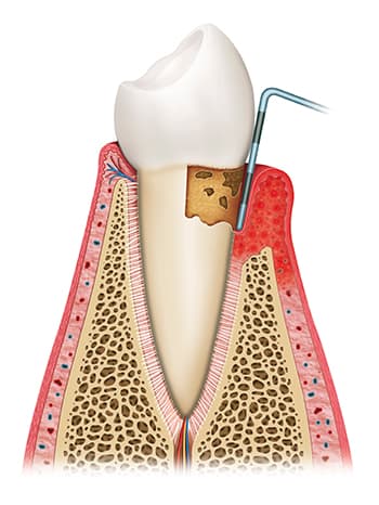 Jutkowitz Periodontics & Implantology photo