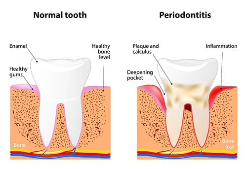 Jutkowitz Periodontics & Implantology photo