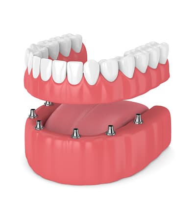 Jutkowitz Periodontics & Implantology photo