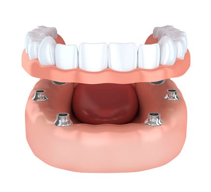 Jutkowitz Periodontics & Implantology photo