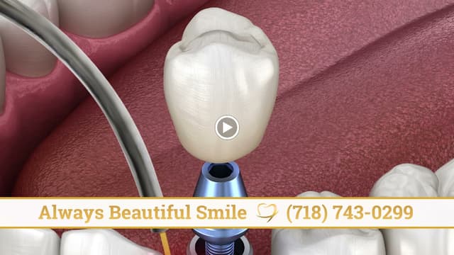 Always Beautiful Smile photo