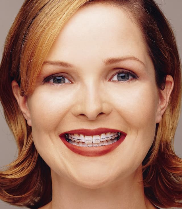 Fox Invisalign And Braces of Sunrise photo