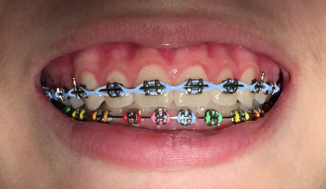 Cooper Orthodontics photo