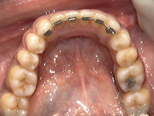 Fox Invisalign And Braces of Fort Lauderdale photo