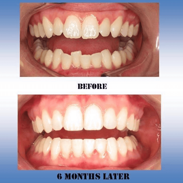 Freeman Orthodontic Specialists photo