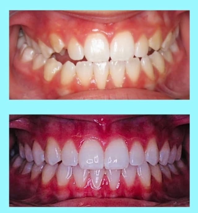 Freeman Orthodontic Specialists photo