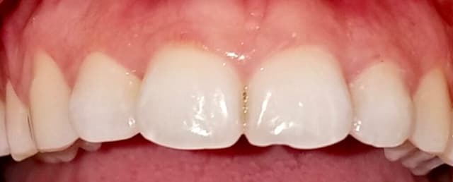 Gentle Teeth & Braces Of Pembroke Pines photo