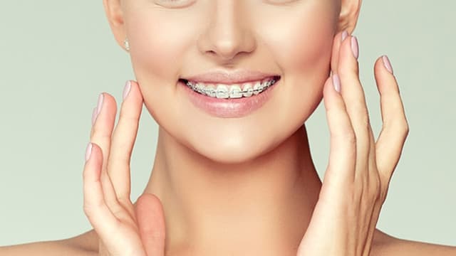 On the Go Braces photo