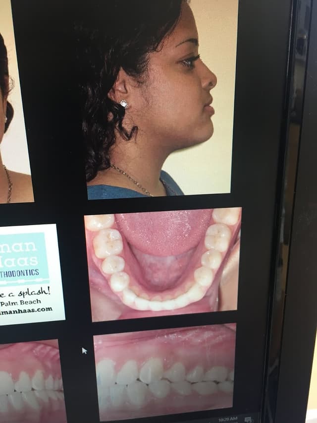 Freedman and Haas Orthodontics - West Palm Beach photo