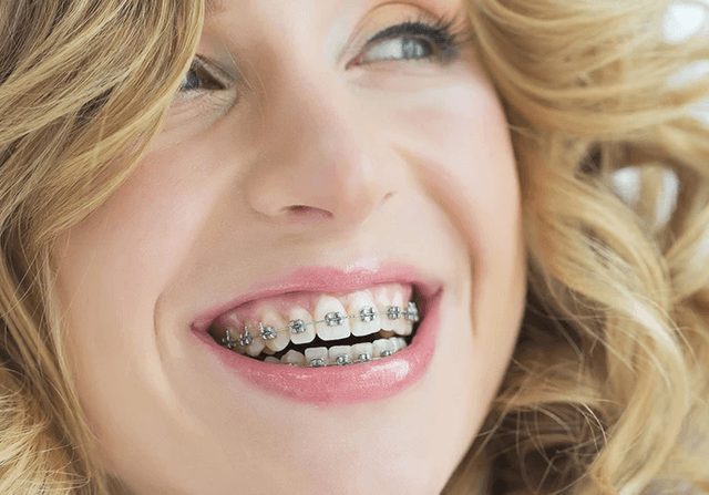 Palm Beach Braces- Braces in Royal Palm Beach photo