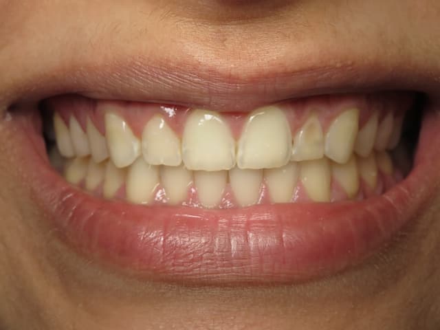 Foothill Smiles photo