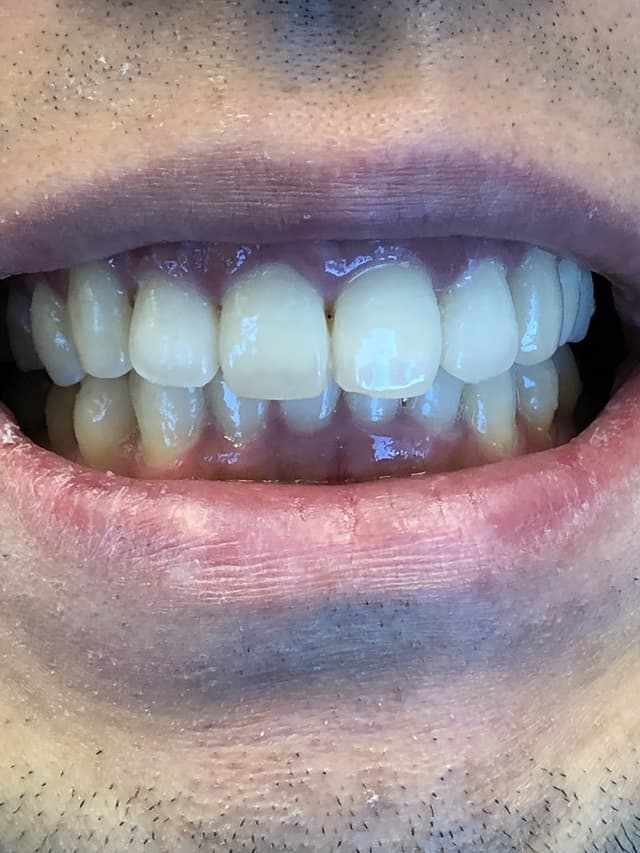 Foothill Smiles photo